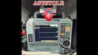 Asystole in EMS  Cardiac Rhythms  ParamedicEMS Cardiology [upl. by Lancelle]