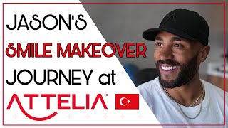 JASONS SMILE MAKEOVER JOURNEY attelia milliondollarsmile [upl. by Timmie]