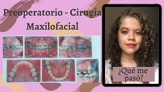 Preoperatorio cirugía maxilofacial I Prognatismo clase 3 I 1er mes I Parte 1 I Diario de una actriz [upl. by Enived]