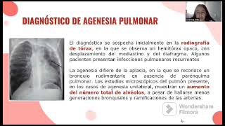 Agenesia pulmonar [upl. by Eilrahs]