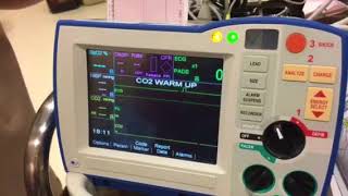 Defibrillator Check For Crash Carts— Zoll ARMC [upl. by Lozar]