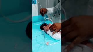 7month Preterm birth baby beautiful mubarak urdu babychild friday newbornbaby viralshort [upl. by Nollie]