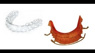 Types of Orthodontic Retainers  and How to Clean Them [upl. by Terina]