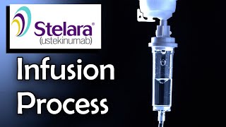 Stelara Infusion Process Ulcerative Colitis Treatment [upl. by Dachy240]