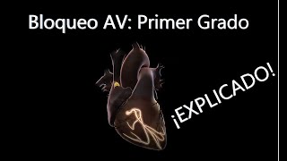 ECG Bloqueo AuriculoVentricular de Primer Grado [upl. by Auric]