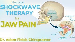 Shockwave for Jaw Pain  ESWT amp TMJ  TMD [upl. by Ahsitruc]