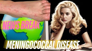 New Break Meningococcal Disease amp More texas [upl. by Mosora]