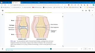 4346 CONCEPTS OF CARE FOR PTS WITH ARTHRITIS AND TOTAL JOINT ARTHROPLASTY PART 1 [upl. by Ennasil463]