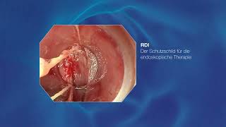 Unser modernstes Endoskopiesystem EVIS X1 Gastroenterologie OLYMPUS [upl. by Violante]