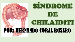 SÍNDROME DE CHILAIDITI INTERPOSICIÓN DEL INTESTINO ENTRE EL HÍGADO Y EL DIAFRAGMA [upl. by Enerod50]