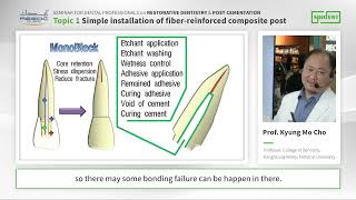 2024 AEEDC Lecture  Simple installation of fiberreinforced composite post [upl. by Sanford253]