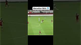 Marcelino ferdinand skills [upl. by Mcclain]