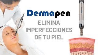 ¿Qué es el Dermapen  Conoce el tratamiento que cambiará tu piel [upl. by Zonnya]