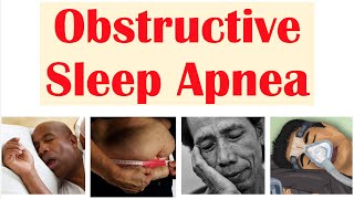 Obstructive Sleep Apnea OSA  Risk Factors Signs amp Symptoms Complications Diagnosis Treatment [upl. by Arehsat822]