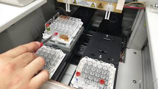 Capillary Electrophoresis [upl. by Fey]