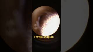 frottis sanguin sous Microscope [upl. by Robb257]