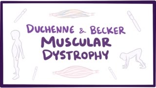 Duchenne amp Becker muscular dystrophy  causes symptoms treatment amp pathology [upl. by Masera]