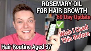 ROSEMARY OIL FOR HAIR GROWTH  Nature Spell Rosemary Oil Review [upl. by Allissa20]