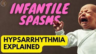 The Terrifying Truth About Infantile Spasms [upl. by Mikol362]