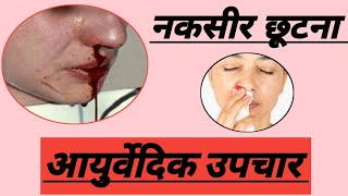 नक्सीर छूटना  रक्तपित्त व्याधि  आयुर्वैदिक उपचार How to cure nose bleeding nakseer नकसीर [upl. by Reinert]