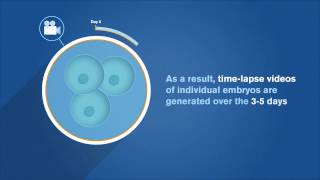 EmbryoScope Patient Information [upl. by Lagas]