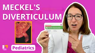 Meckels Diverticulum Alterations in Health  Gastrointestinal Pediatrics  LevelUpRN [upl. by Owain]