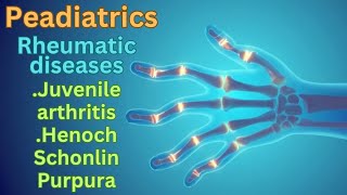 Rheumatic Diseases Pediatrics  Juvenile Rheumatoid Arthritis JRA amp HenochSchönlein Purpura HSP [upl. by Nicolas]