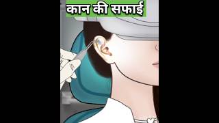 Ear stone removal 3d animation video 🏥 [upl. by Irfan]