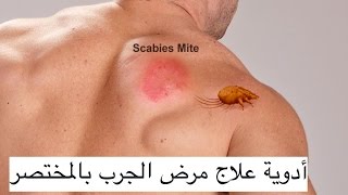 مختصر أدوية علاج الجرب [upl. by Nakeber]