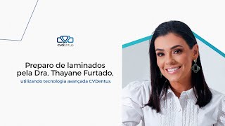 Dra Thayane Furtado  Preparo de laminados com CVDentus [upl. by Salakcin217]