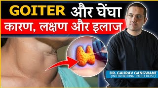 Important Things To Know About Thyroid Goiter  Dr Gaurav Gangwani Interventional Radiologist [upl. by Eibot]