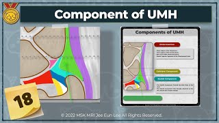 KOR Anatomy18 Component of ulnomeniscal homologue TFCC wrist MRI [upl. by Gnort]