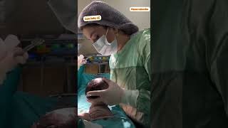 CSECTION delivery duty viralvideo hospital youtube viralvideo duty docters mdmedical00 [upl. by Kraft]