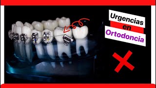 ¿QUÉ HACER 🚨Urgencias en Ortodoncia [upl. by Schramke8]