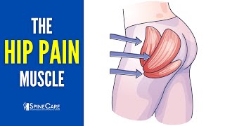 The Hip Pain Muscle How to Release It for INSTANT RELIEF [upl. by Alleynad]