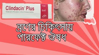 Clindacin Plus Gel  what is clindamycin gel used to treat Bangla [upl. by Gaddi339]