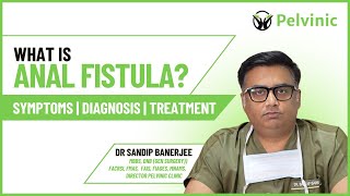 What is Anal Fistula  What are the causes amp symptoms of Anal Fistula   Anal Fistula prevention [upl. by Ecnedurp176]