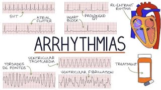 Hospital Training  Internal medicine  Arrhythmias Dr Mohammed Mahdi 20242025 [upl. by Cash674]