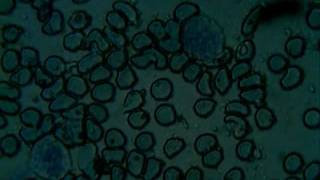 Frottis sanguin au microscope Microscope blood smear [upl. by Yemerej202]