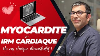 Myocardite en IRM cardiaque  tout comprendre en 15 minutes [upl. by Suhail326]