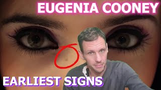 Warning signs in Eugenia Cooneys earliest content [upl. by Notpmah430]