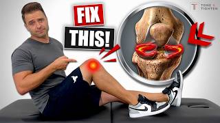 Fix Meniscus Tear Without Surgery Knee Pain Relief Exercises [upl. by Ecinreb768]