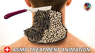 😨💉infected neck treatment  Asmr deep cleaning 2d animation  asmr sleep  maggot infection [upl. by Kraus99]