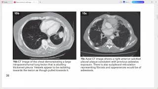 RADIOLOGY EXAM CASES SH [upl. by Fevre]