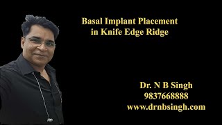 basal implant placement in knife edge ridge  Dr NBsinghmp4 [upl. by Ellac]