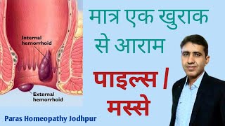 मस्से  पाइल्स  बवासीर का परमानेंट इलाज  Best Homeopathic Medicine For piles  Piles Treatment [upl. by Eilarol]