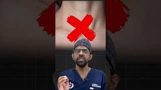 Thyroid Nodule Treatment  Thyroid Artery Embolization TAE thyroid tae doctor ytshortsindia [upl. by Yaron]