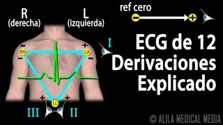 ECG de 12 Derivaciones Explicado Animación Alila Medical Media Español [upl. by Irmgard524]