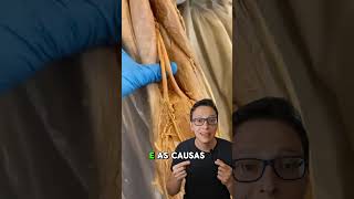 Nervo Ciático 😮🦵 curiosidades enfermagem medicina medico saude enfermeira anatomia ciatico [upl. by Lulu]