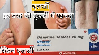 How to use Bilastine 20 mg  Dose Side effect  Benefits in hindi  Bilastine [upl. by Kimmel316]